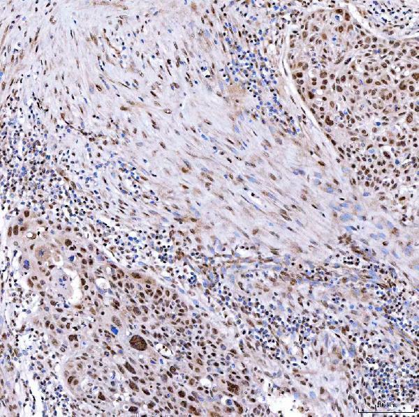 a01888 3 smarca2 primary antibodies ihc testing 6