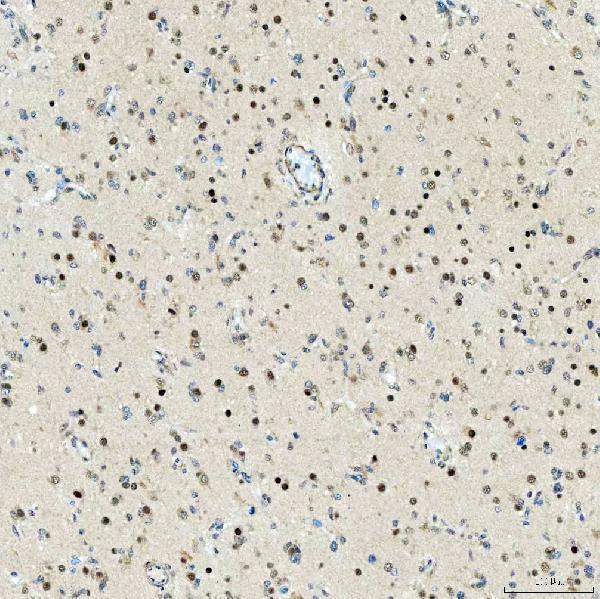 a01888 3 smarca2 primary antibodies ihc testing 7