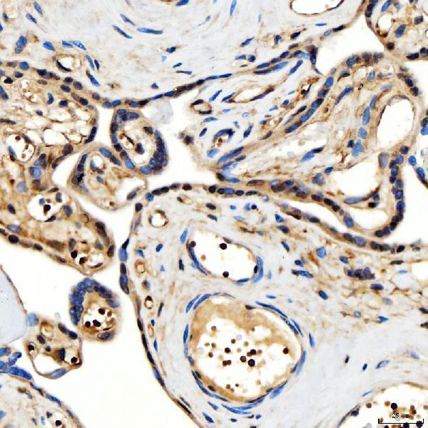 a01888 3 smarca2 primary antibodies ihc testing 8