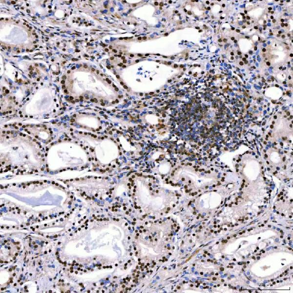 a01888 3 smarca2 primary antibodies ihc testing 9