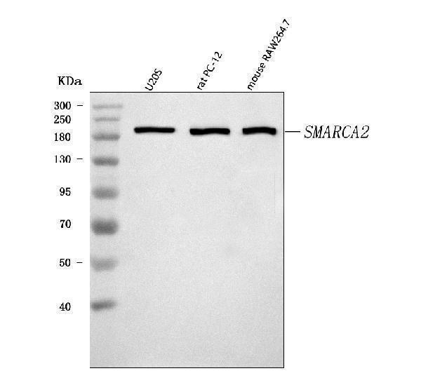  Western blot analysis of SMARCA2/BRM using anti-SMARCA2/BRM antibody (A01888-3)