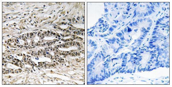 a01889 mdm4 primary antibodies ihc testing 1