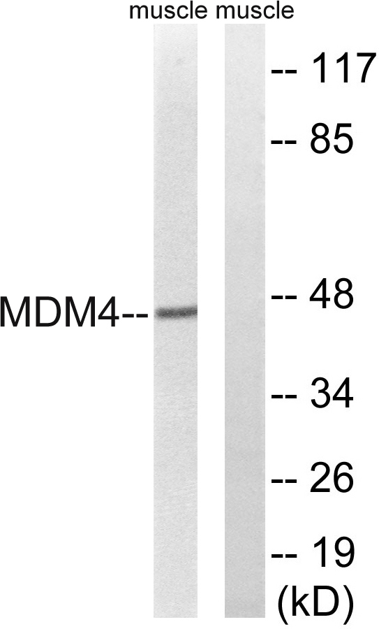 a01889 mdm4 primary antibodies wb testing 3