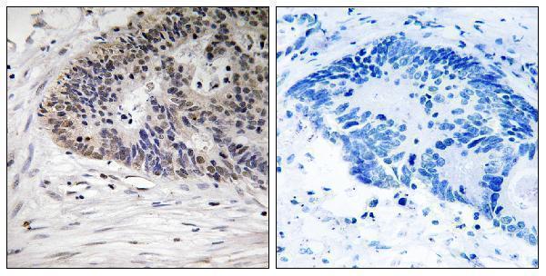 a01889s367 mdm4 primary antibodies ihc testing 3