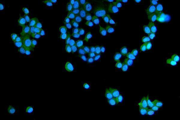 a01891 rab5 primary antibodies if testing 7