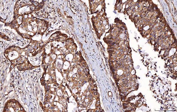  IHC analysis of RAB5A/B/C using anti-RAB5A/B/C antibody (A01891)