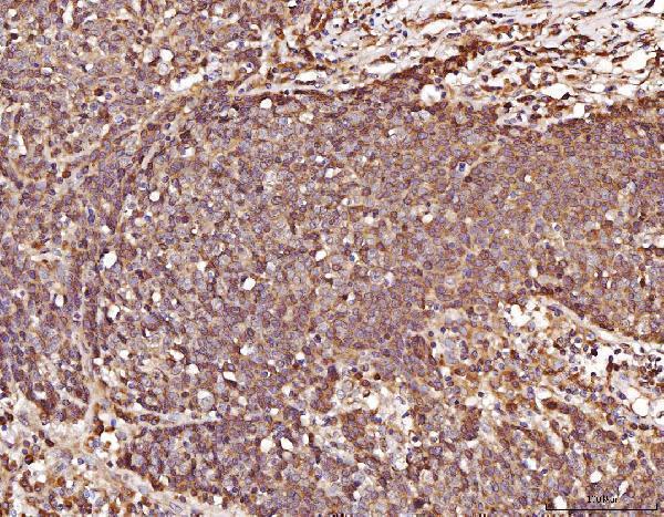  IHC analysis of RAB5A/B/C using anti-RAB5A/B/C antibody (A01891)