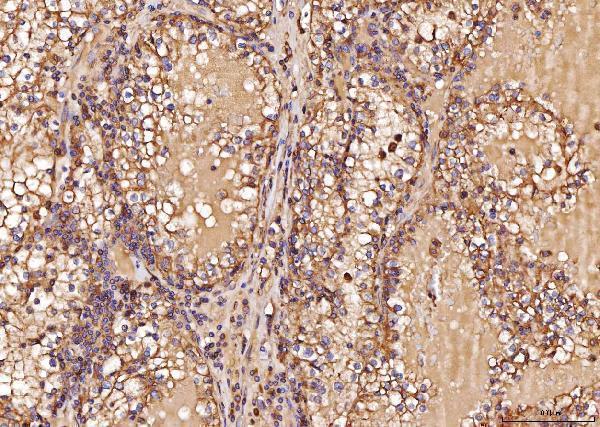 a01891 rab5 primary antibodies ihc testing 5
