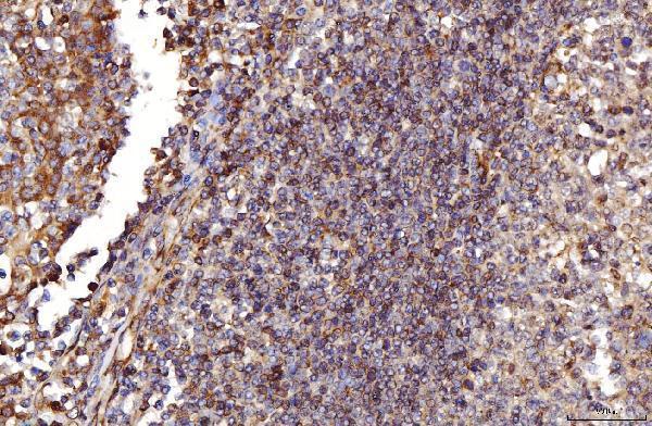 a01891 rab5 primary antibodies ihc testing 6
