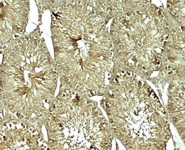 a01892 sox4 primary antibodies ihc testing 2