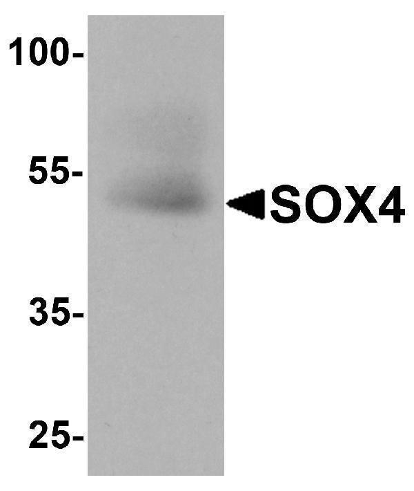 a01892 sox4 primary antibodies wb testing 1