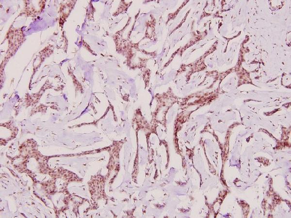 a01893t301 ppp2ca primary antiboties ihc testing 2
