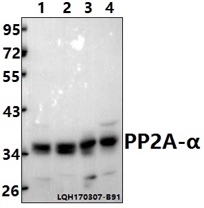 a01893t301 ppp2ca primary antiboties wb testing 1