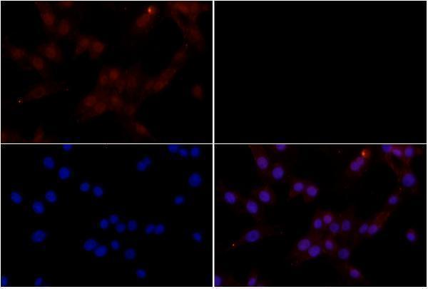 a01893y307 ppp2ca primary antiboties if testing 3