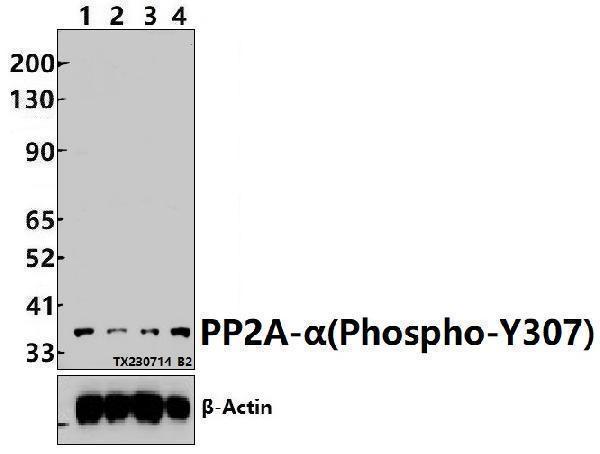 a01893y307 ppp2ca primary antiboties wb testing 1
