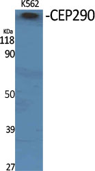 a01894 1 cep290 primary antibodies wb testing 2