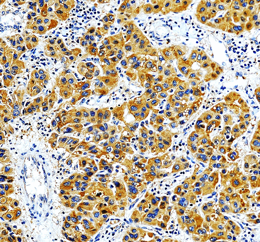 a01895 3 micu1 primary antibodies ihc testing 1