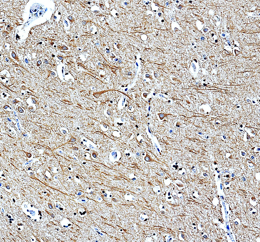 a01895 3 micu1 primary antibodies ihc testing 2