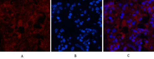 Immunofluorescence analysis of Human-appendix tissue