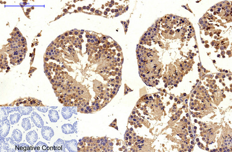 Immunofluorescence analysis of Hela cell