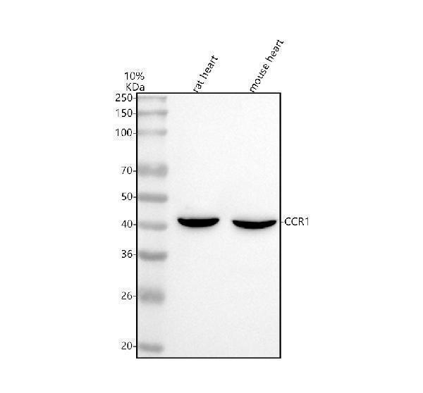  Western blot analysis of CCR1 using anti-CCR1 antibody (A01896-2)