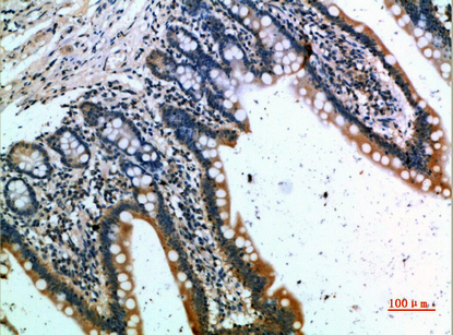 a01896 ccr1 primary antibodyes ihc testing 1