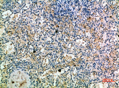 a01896 ccr1 primary antibodyes ihc testing 2