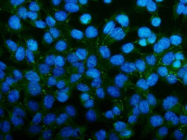 a01897 2 pard3 primary antibodies if testing 4