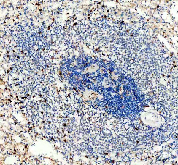 IHC analysis of C5AR1 using anti-C5AR1 antibody (A01898-3)