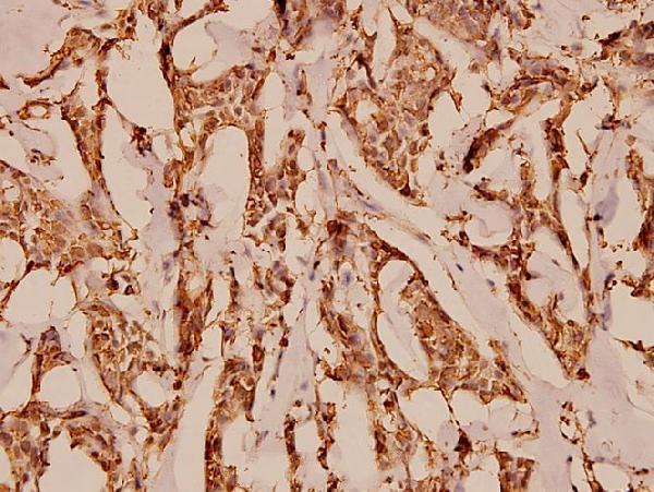 a01898s334 c5ar1 primary antiboties ihc testing 2