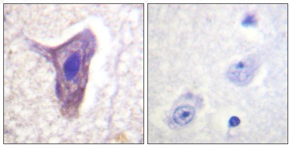 a01898s338 c5ar1 primary antibodies ihc testing 2