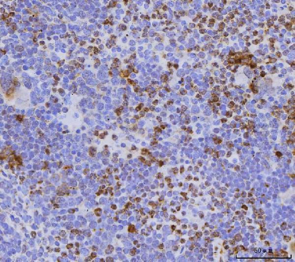  IHC analysis of Cdc25b using anti-Cdc25b antibody (A01899)