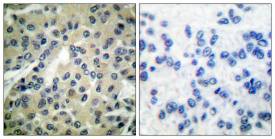 a01899s323 cdc25b primary antibodies ihc testing 4