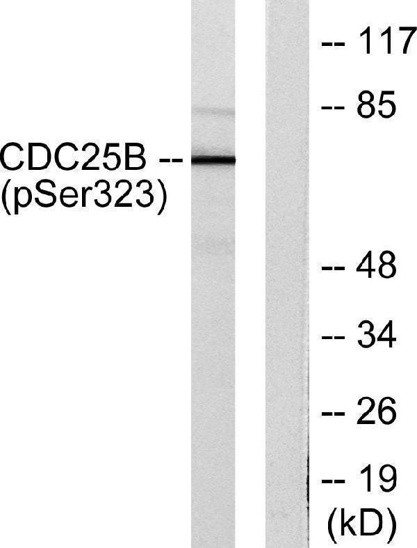 a01899s323 cdc25b primary antibodies wb testing 3