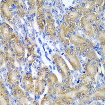 Immunofluorescence analysis of Rat Eye using CRYAA Rabbit pAb  at dilution of 1:200 