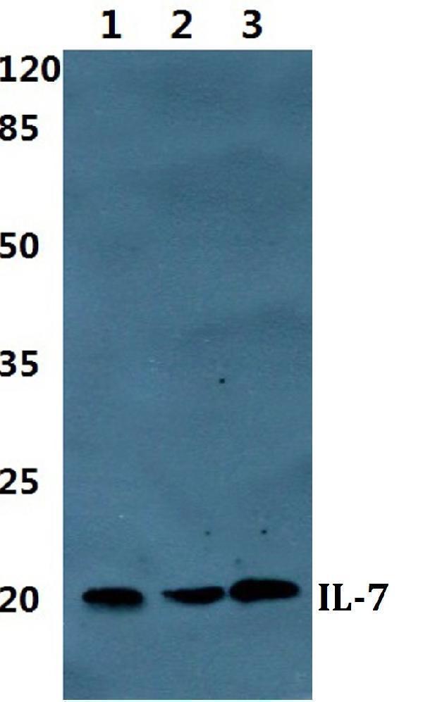 Western blot (WB) analysis of IL7 polyclonal antibody at 1:500 dilution
Lane1:HEK293T cell lysate
Lane2:Raw264