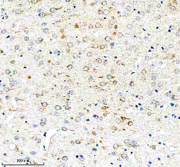 IHC analysis of PCM1 using anti-PCM1 antibody (A01903-1)