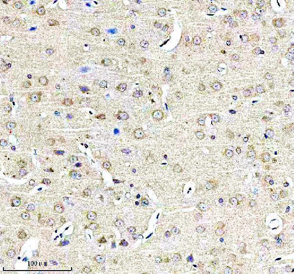 a01903 1 pcm1 primary antibodies ihc testing 4