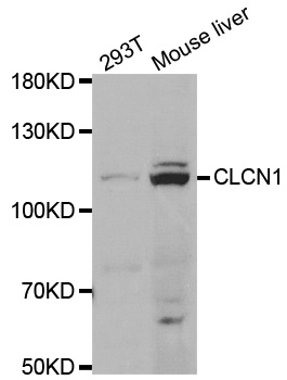 a01904 clcn1 primary antiboties wb testing 1