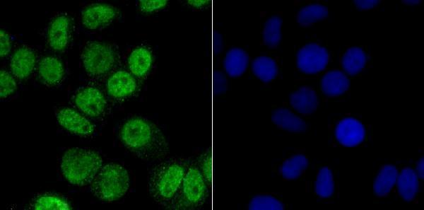 ICC staining CAMKIV in Hela cells (green)