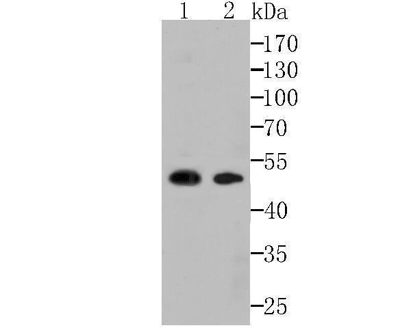 Western blot analysis of CAMKIV on mouse brain and rat brain lysates using anti-CAMKIV antibody at 1/1,000 dilution
