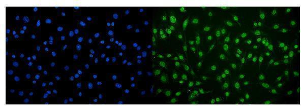 a01905 2 camk4 primary antibodies if testing 6