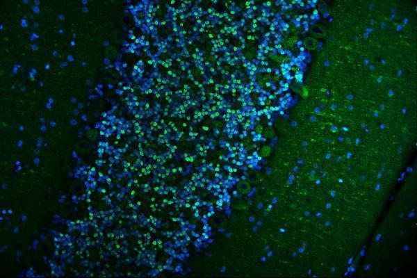 a01905 2 camk4 primary antibodies if testing 8