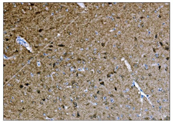  IHC analysis of CAMKIV/Camk4 using anti-CAMKIV/Camk4 antibody (A01905-2)