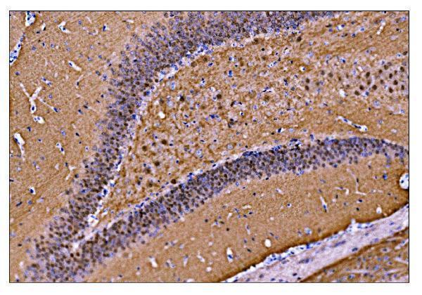  IHC analysis of CAMKIV/Camk4 using anti-CAMKIV/Camk4 antibody (A01905-2)