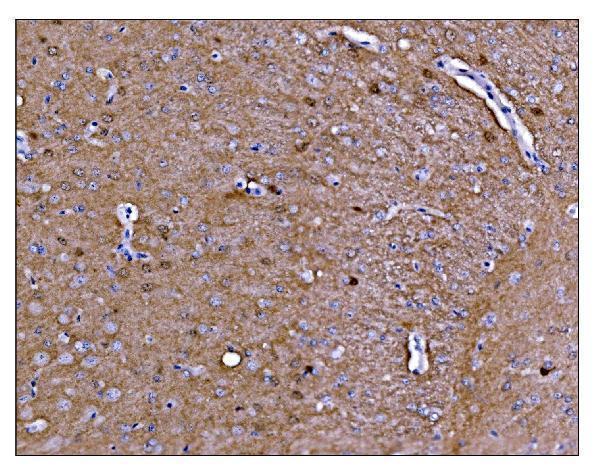 a01905 2 camk4 primary antibodies ihc testing 4