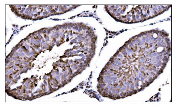a01905 2 camk4 primary antibodies ihc testing 5