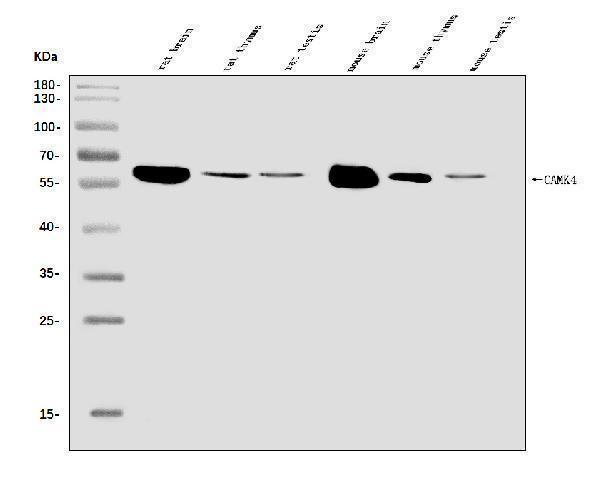 Western blot analysis of CAMKIV/Camk4 using anti-CAMKIV/Camk4 antibody (A01905-2)