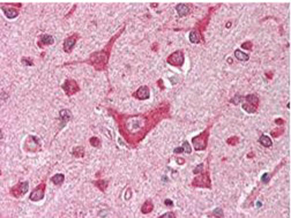 Immunohistochemistry of Anti-CAMK4 antibody