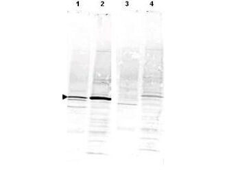 Western blot using Boster